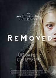 removed